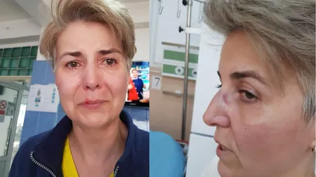 FOTO O asistentă de la ATI Giurgiu, bătută cu bestialitate în spital, din gelozie: 