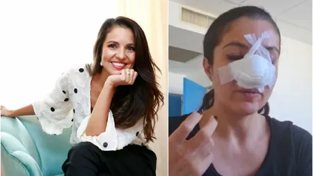 Cristina Joia, prima apariţie după ce a fost desfigurată: 