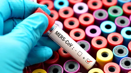 Coronavirusul de 10 ori mai letal decât Covid-19 a fost descoperit. Alertă medicală
