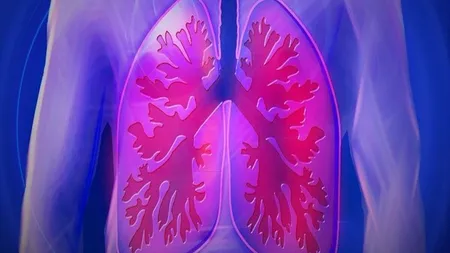 Tratament naturist pentru plămâni. Cum să-ți cureți sistemul respirator în mod natural