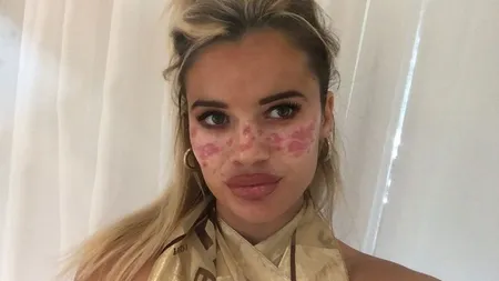 TikTok face noi victime. O vedetă a fost la un pas să rămână oarbă, după ce a încercat un truc de înfrumusețare