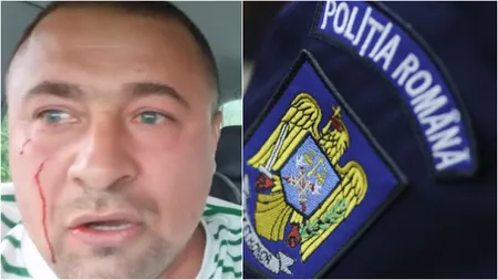 Poliţia s-a răzgândit în cazul activistului bătut la Buzău. Cei trei agresori din Buzău au fost reținuți