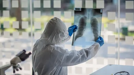 Bilanţ coronavirus 31 iulie. Numărul cazurilor noi de Covid este în creştere. Au fost raportate 3 decese