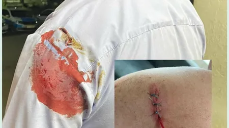 Poliţist tăiat cu sapa de un scandalagiu în Bacău