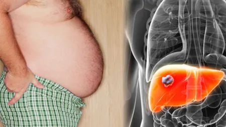 Reţeta care revitalizează ficatul, îl purifică şi curăţă de toxine - amestecă sfeclă roşie, mocov şi măr pentru efecte miraculoase