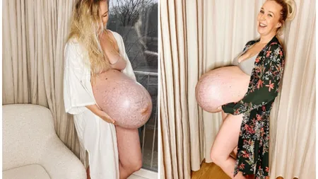 Cum arată burta unei femei însărcinate cu tripleţi. Internauţii au rămas fără cuvinte: 