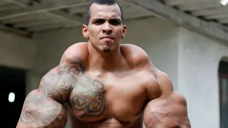 Cum arată şi cu ce se ocupă acum Hulk al Braziliei. A fost la un pas de moarte după şi-a injectat ulei în braţe