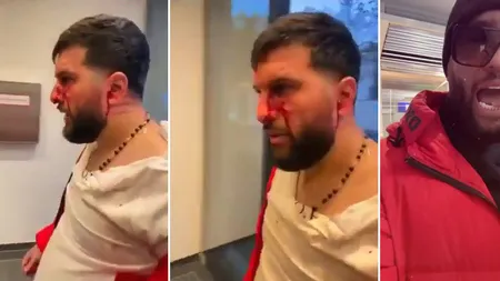 Tzancă Uraganu, dezvăluiri despre bătaia încasată în Germania. De ce a fost, de fapt, agresat manelistul