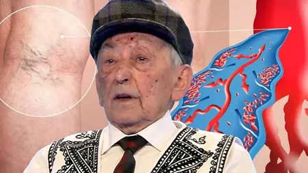Leacul miraculos care dizolvă cheagurile de sânge. Academicianul Ovidiu Bojor îl recomandă în tromboflebită și ateroscleroză