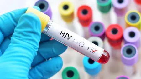 O nouă variantă mai virulentă de HIV, descoperită în Olanda. Este alertă în toată Europa