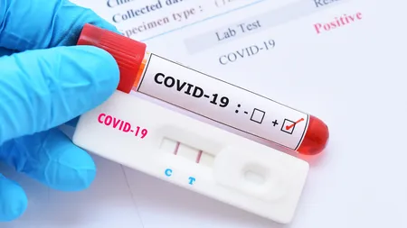 Bilanţ coronavirus 11 aprilie. Puţin peste 1.000 de cazuri COVID-19 şi 3 decese în 24 de ore