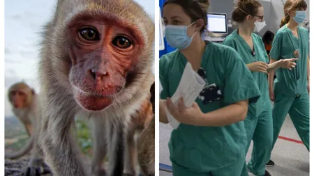 Un nou caz de variola maimuţei confirmat în România