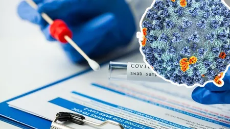 Bilanţ coronavirus 12 august 2022. Peste 5.700 de cazuri noi COVID-19 şi 20 de decese în 24 de ore