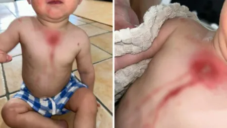 Ce s-a întâmplat cu un copil după ce a mâncat o lămâie în curtea casei. Mama băiețelului a fost în stare de șoc: „Nu mi-am imaginat că se poate întâmpla asta”