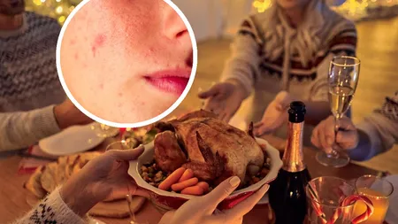 Cum ne afectează pielea alimentele pe care le consumăm de sărbători