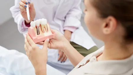 Ce presupune restaurarea dentară și care sunt procedurile prin care poate fi realizată