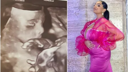 Adriana Simionescu, fiica cea mică a lui Adrian Minune a publicat prima poză cu chipul bebelușului nenăscut