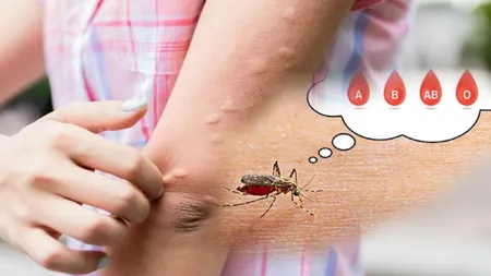 Trucuri pentru a te proteja de țânțari în sezonul cald
