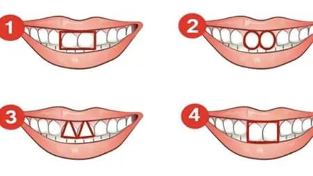 Test de personalitate. Ce spune despre tine forma dinților pe care o ai. Află ce tip de personalitate ai