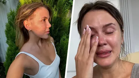 Emily Burghelea, dezvăluiri cutremurătoare despre viața de după accident: „Am renunțat la orice gând negativ!” Ce schimbări este hotărâtă să facă