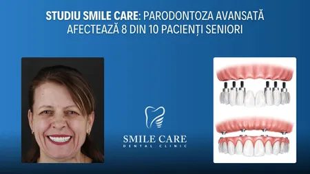 Studiu SMILE CARE: Parodontoza avansată afectează 8 din 10 pacienți seniori, iar proteza fixă pe implanturi oferă o soluție durabilă și estetică