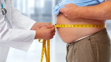 Studiu SRCM: 6 din 10 români sunt supraponderali sau obezi: „Vorbim despre o adevărată pandemie a obezității”