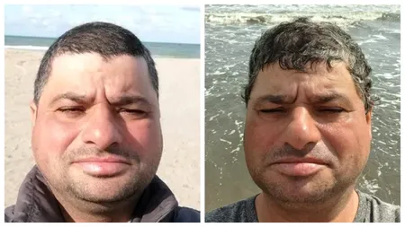 GALERIE FOTO Ce face astăzi Tudorel Popa, alias „omul bormașină” de la Românii au Talent. Povestea sa este foarte emoționantă