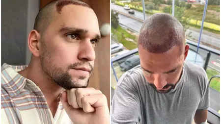 Vlad Gherman, la prima apariție publică după intervențiile de implant de păr. A ajuns de nerecunoscut FOTO