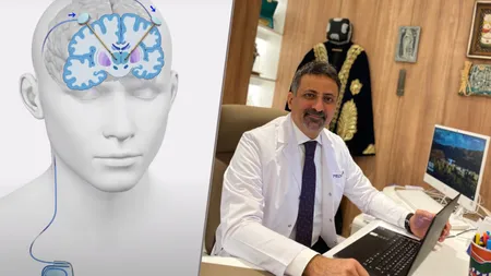 Stimularea profundă a creierului, o soluție inovatoare pentru pacienții români cu boala Parkinson