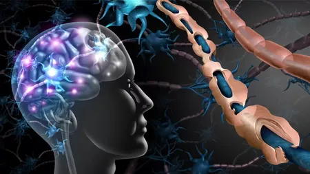 Scleroza multiplă, o boală cu simptome invizibile care afectează peste 10.000 de români