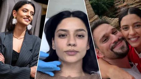 După operația de deviație de sept, Oana Moșneagu a ajuns din nou pe mâna esteticianului. La ce intervenție a apelat, de data aceasta, actrița