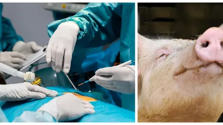 Primul ficat de porc transplantat unui pacient uman. Un experiment în premieră mondială