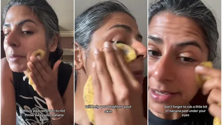 Noul truc de beauty de pe TikTok care i-a oripilat pe dermatologi! Cum sunt cojile de banană folosite pe post de botox