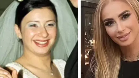Anamaria Prodan rupe tăcerea despre operaţiile estetice. Ce nu ar accepta niciodată să-şi facă la faţă