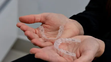 Aparat dentar Invisalign: tratament și confort pentru un zâmbet perfect!