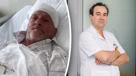 Bărbat de 67 de ani, salvat de medicii din Iași după ce s-a prezentat la spital cu o tumoră cerebrală de aproximativ 10 cm