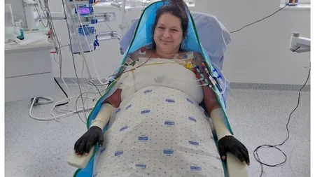 Noi detalii despre pacienta cu arsuri infectată la Floreasca și transferată în Belgia. Sora ei anunță progrese incredibile: ”Paşi mici, dar extrem de importanţi”