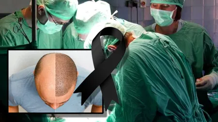 Un bărbat a murit după ce și-a făcut un transplant de păr în Turcia