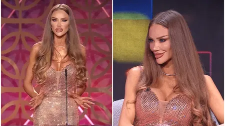 Bianca Drăgușanu, schimbată complet la față. Motivul pentru care are bărbia atât de ascuțită: 