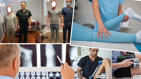 Cât costă să crești în înălțime: O operație ajunge la zeci de mii de euro, iar complicațiile sunt severe