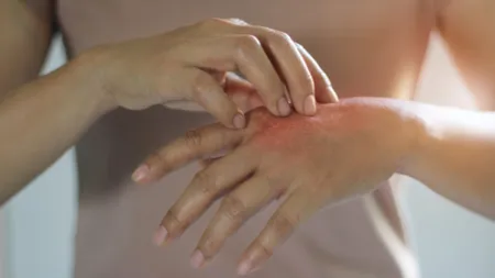 Încă două femei au ajuns la spital cu suspiciune de infecție cu lepră. Anunțul făcut de Ministerul Sănătății