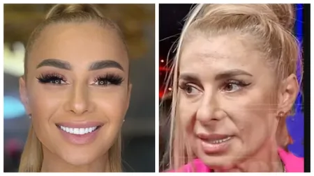 Câte operaţii estetice are, de fapt, Anamaria Prodan. 