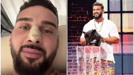 Cum arată nasul lui Dorian Popa după operație. Influencerul și-a dat bandajele jos: 