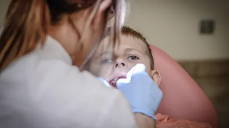 Ce servicii stomatologice sunt decontate de CNAS și care sunt condițiile pentru a beneficia de ele. Cine poate merge GRATIS la dentist