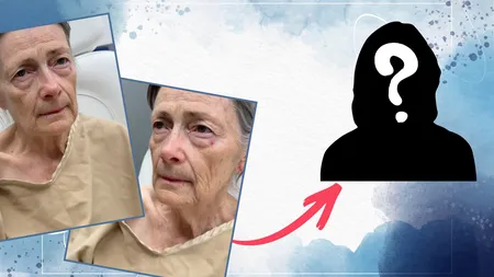 Transformarea incredibilă a unei femei de 70 de ani după un facelift! A plâns de fericire în brațele medicului: „Când oamenii mă întreabă câți ani am, o să spun 40”