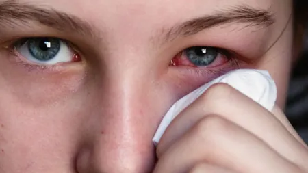 Și tu folosești ceai de mușețel în zona ochilor? Medicii trag un semnal de alarmă: 