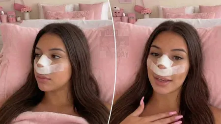 O influenceriță de pe Instagram și TikTok s-a operat pentru ca viitorii copii să nu îi moștenească nasul: „Nu vreau ca ei să crească fiind hărțuiți așa cum am fost eu în copilărie”
