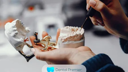 Implant dentar la Dental Premier din București: de ce ajung românii să compare tot mai atent prețurile?
