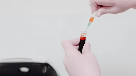 Măsură extremă după moartea rezidentului de la Floreasca. Medicii care intră în gardă ar putea fi testați antidrog!