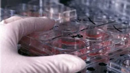 Concorde construieste primul centru de tratament cu celule stem din Romania